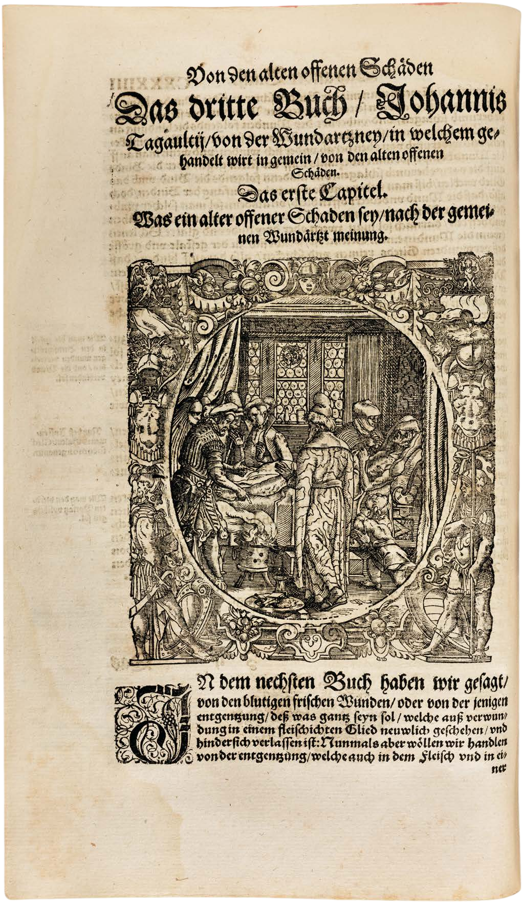 Tagault’s Renaissance Surgical Manual