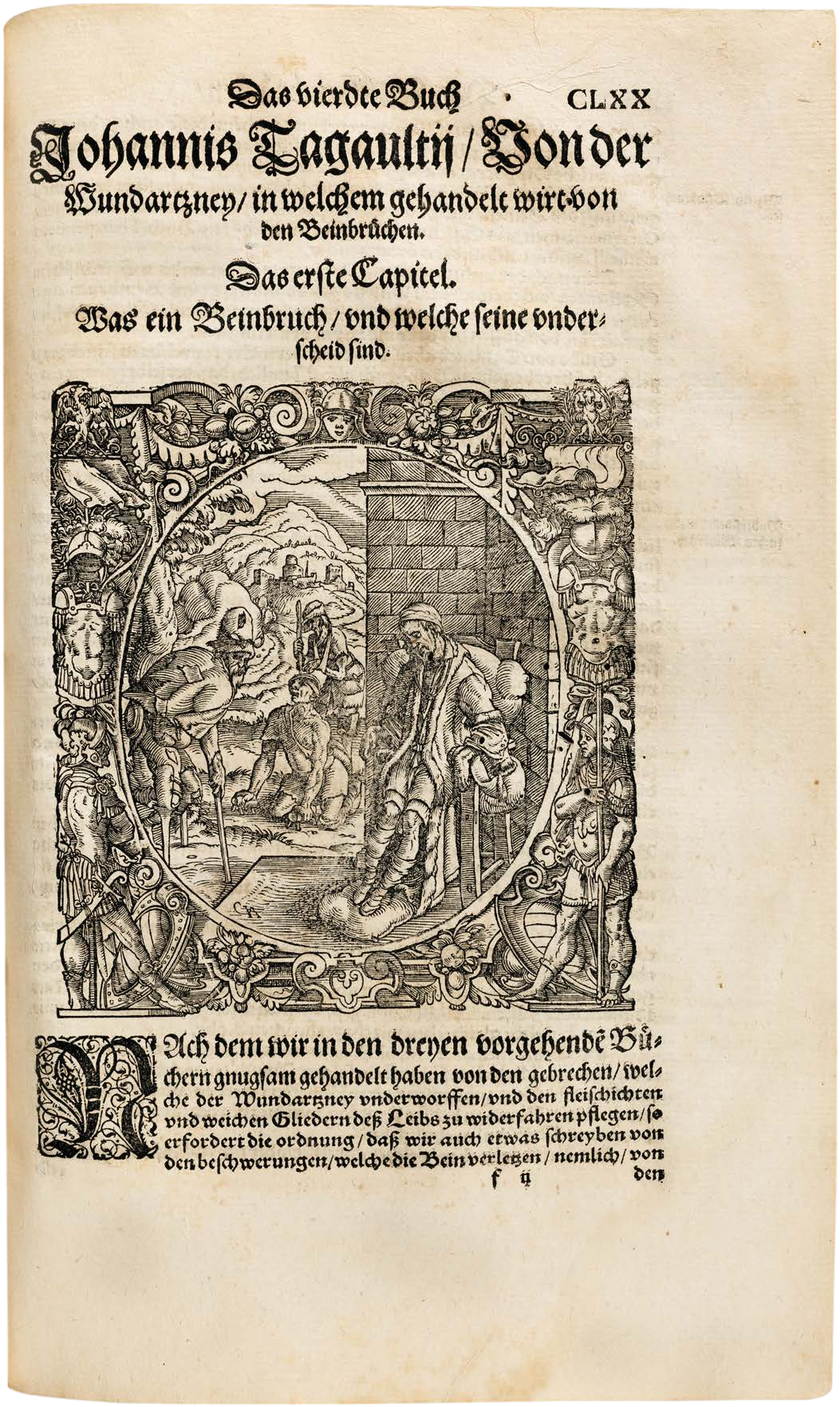 Tagault’s Renaissance Surgical Manual